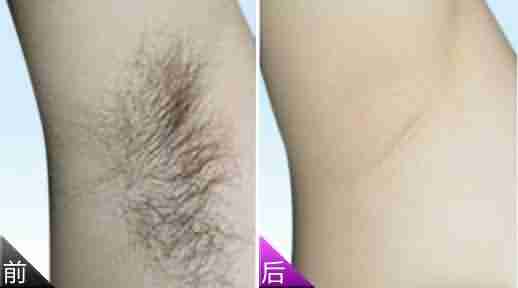 ��Ҹ�� ���ݾųɻ�����ѡ���ݱ���-lni