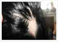 ���ݱ���ҽ������ͺ���Ĵ���-lni