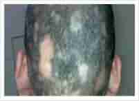 ���ݱ���ҽ������ͺ���Ĵ���-lni