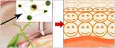 治疗皮炎 北大省时省心更省钱-lni