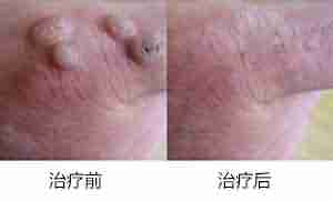 ����ҽ�����Ѱ���࣬�⡰�ࡱ���⡰�ǡ�!-lni