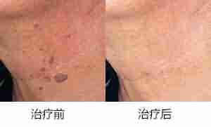 ����ҽ�����Ѱ���࣬�⡰�ࡱ���⡰�ǡ�!-lni