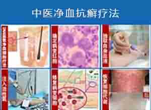 中医净血抗癣疗法 根治顽癣不复发-lni