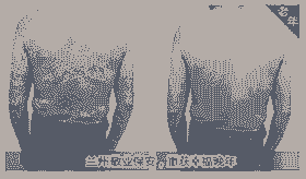 治疗牛皮癣 兰州北大是您的正规佳选择-lni