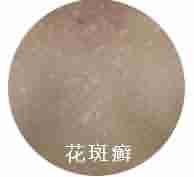 ����ҽ��������ʶƤ��Ѣ��֢״-lni