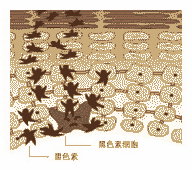 【黄褐斑】OS医学分层祛斑-lni