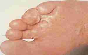 ������ˮ�ݡ���Ƥ����ô����-lni