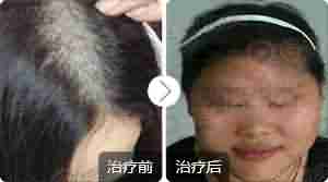 ����ҽ��������ư�ͺ�ķ���-lni