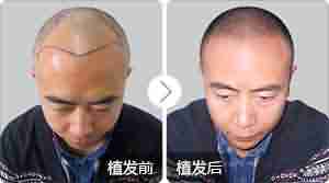 ����ҽ��������ư�ͺ�ķ���-lni