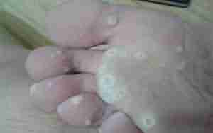 ������ˮ�ݡ���Ƥ����ô����-lni