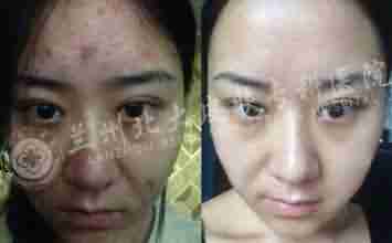 ŧ���Ͷ�����ô��?-lni