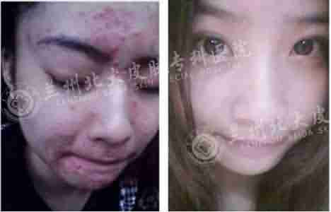 ŧ���Ͷ�����ô��?-lni