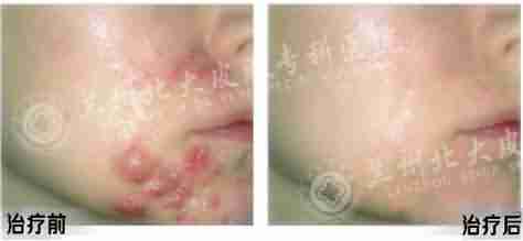 ŧ���Ͷ�����ô��?-lni