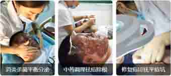 医生解析:青春痘的危害有哪些-lni