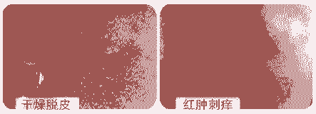 ����ҽ��Ͽ�������Ƥ������-lni