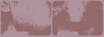 ����ҽ��Ͽ�������Ƥ������-lni