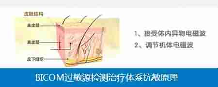 荨麻疹病因复杂-lni