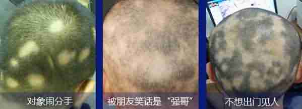 ���ݱ���ҽ������ͺ���Ĵ���-lni