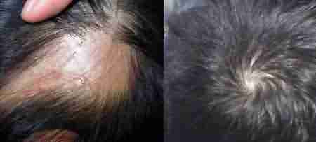 ���ݱ���ҽ������ͺ���Ĵ���-lni