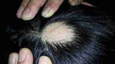 ����ҽ��������ư�ͺ�ķ���-lni