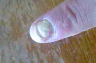 ���ݱ���Ƥ������������ƻ�ָ��Ч����-lni