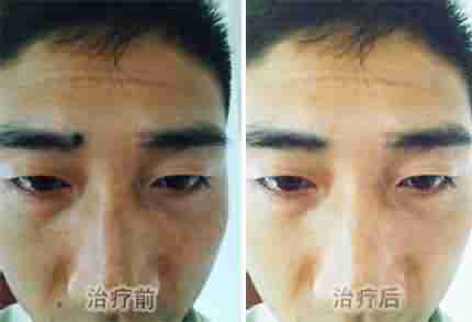 �˽�ƺְ�֢״ �緢��������-lni