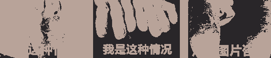 牛皮癣有哪些明显特征-lni