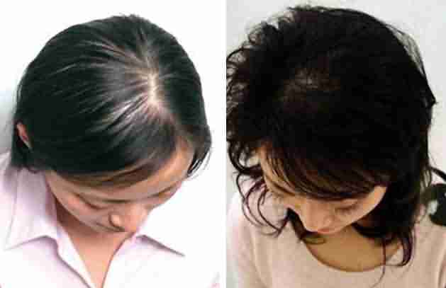 Ů���ѷ�����Ӧ����ô��-lni