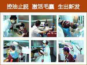 正规医生解析:脱发的症状表现-lni