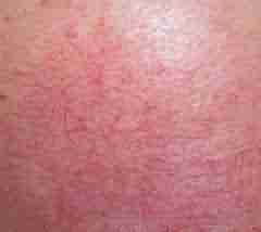 ������Ѫ˿ ѡ�����ݱ���-lni