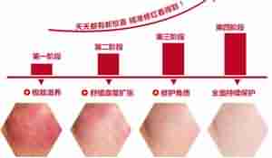 ������Ѫ˿ ѡ�����ݱ���-lni