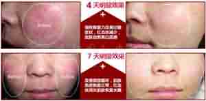 ������Ѫ˿ ѡ�����ݱ���-lni