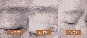 北大中西医结合治疗白癜风-lni