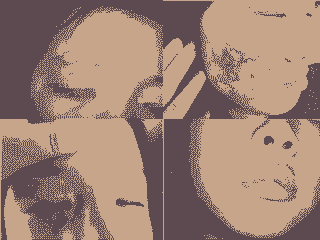 白斑是什么?有哪些症状表现?-lni