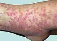 ҽ�����������������Ĳ���-lni