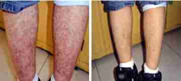 ҽ�����������������Ĳ���-lni