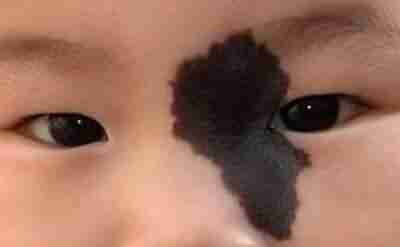 ���ϳ�̥�ǵ�ԭ����ʲô?-lni