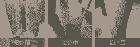 ѧʪ֢״ԭƷ-lni