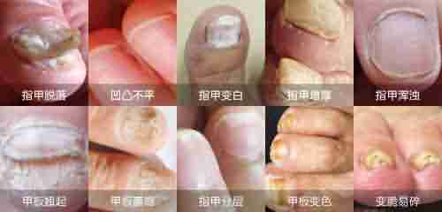 ��ָ��ȥҽԺ���ĸ���-lni