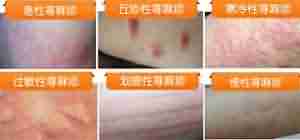 ݡҪʲô-lni