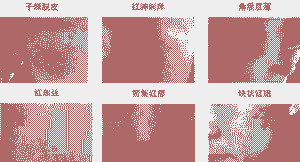 皮肤过敏要挂什么科-lni