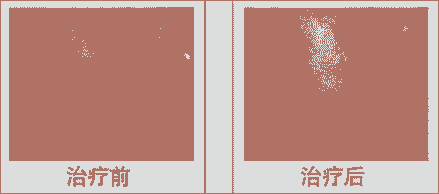 皮肤过敏要挂什么科-lni