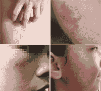 ƤȥҽԺҪʲô-lni