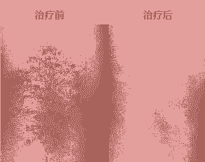 ƤȥҽԺҪʲô-lni