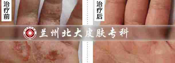 ʪȥҽԺĸ-lni