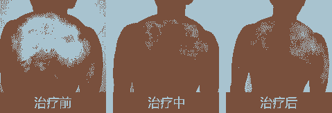 ݡ֢״Щ-lni