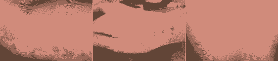 ƼݡļҽԺ-lni