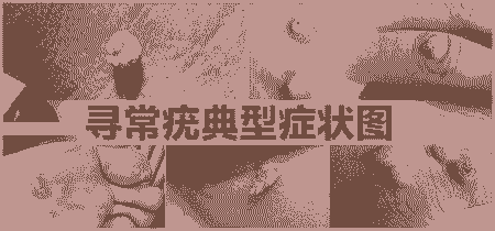 Ѱ��������ʲôԭ�������-lni