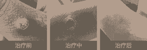 Ѱ��������ʲôԭ�������-lni