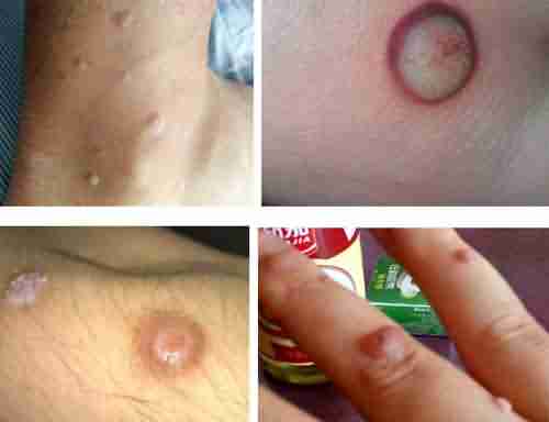 ����Ѱ����(����)Ҫ����Ǯ-lni